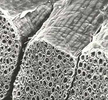 Peripheral Nerve Epineurium Perineurium Fasciculi This is a scanning electron microscope image in