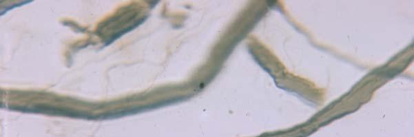 Medullated Nerve Node of Ranvier Schwann cell This tissue has