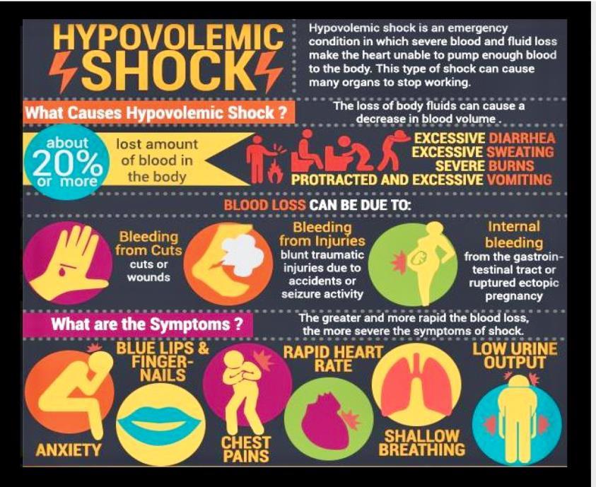 Hypovolemic Shock Manifestations: Restlessness; pale, cool, clammy skin, tachycardia, tachypnea, flat, non-distended