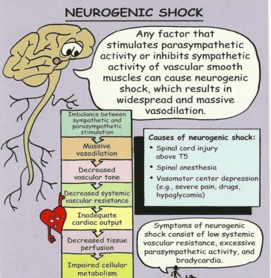 -improperly administered anesthesia -drugs and meds the affect the autonomic nervous system S/sx: the clinical characteristics of neurogenic shock are signs of parasympathetic stimulation.