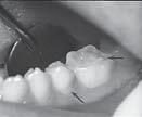 Dental Implications.