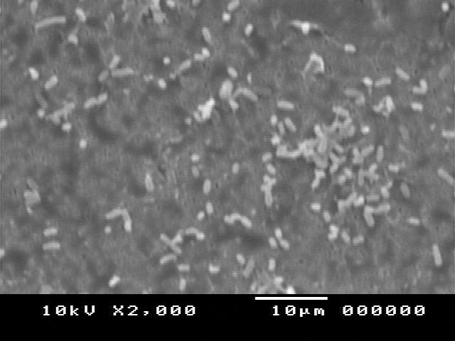 ACKNOWLEDGMENT This study was supported by Research Grant from Chulalongkorn University, Thailand. a) Figure 7. Scanning electron microscope images of B.