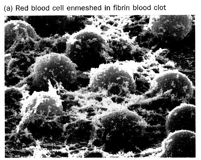 Function: Platelets play a part in blood clotting, forming a temporary plug at wound or cut. Clotting is important because: o It prevents excessive loss of blood from the body through a wound or cut.
