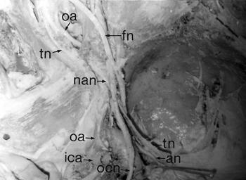 ocn, oculomotor n. fn, frontal n. ln, lacrimal n. Magnification 6.3 x 0.4 Fig.