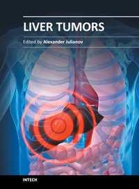 Liver Tumors Edited by Prof.