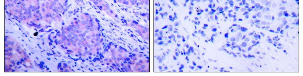 Specificity/Sensitivity: PDK1 (phospho-ser241) antibody detects endogenous levels of PDK1 only when phosphorylated at serine 241.
