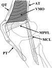 Medial Patellofemoral Ligament Main constraint in EARLY flexion Checkrein to lateral translation Taut and elongated in full extension Decreasing contribution after 30 degrees Shortens and lax with