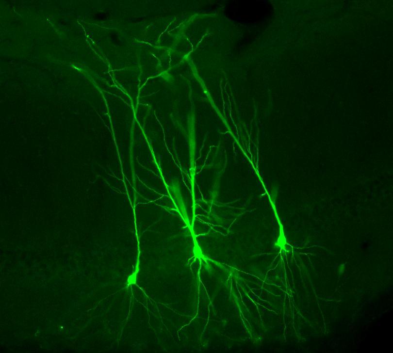 Pyramidal cells labelled in vivo by