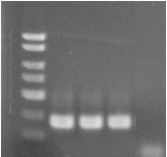 D. Pneumocystis jirovecii PCR Assay Interpretation For the analysis of the PCR data, the entire 20 µl PCR reaction should be loaded on a 1X TAE 2% Agarose DNA gel along with 10 L of Norgen s DNA