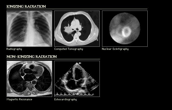GETTING TO THE HEART OF THE MATTER WITH MULTIMODALITY CARDIAC IMAGING Organ Review Meeting 25 September Disclosures None relevant to this presentation Mini Pakkal Assistant Professor of Radiology