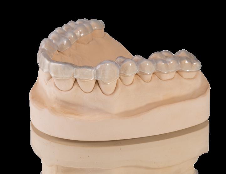 SMART MATERIAL SELECTION VarseoSmile Splint The resin for 3D printing of occlusal splints The resin s excellent flow properties produce a dense surface and high level of impact strength for