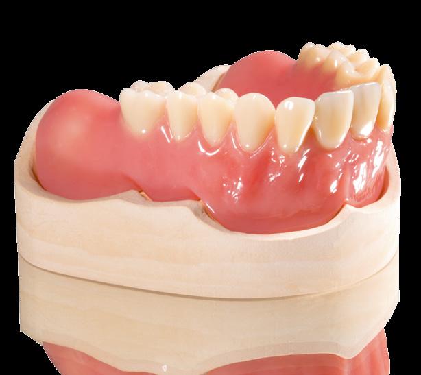 SMART MATERIAL SELECTION Coming soon: VarseoSmile Temp Coming soon VarseoSmile Dent The resin for 3D printing of full denture bases The smooth surfaces of the printed denture bases form offer the