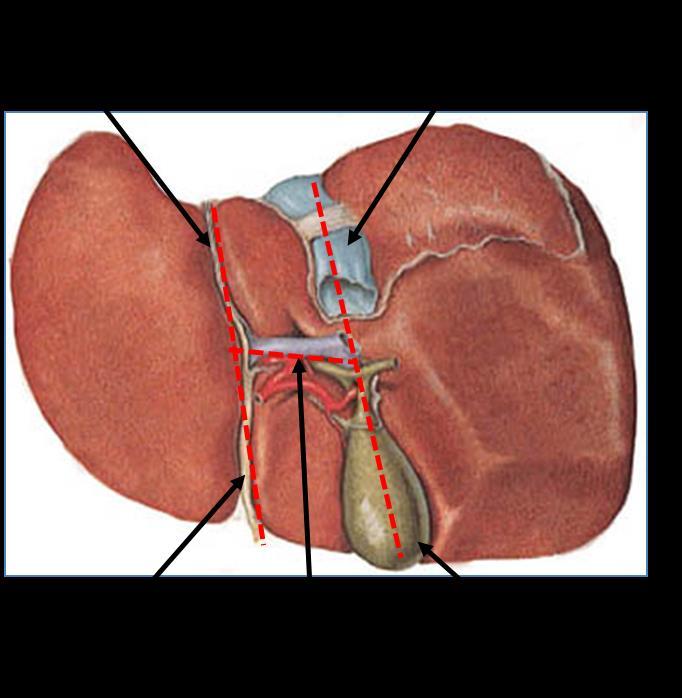 Fissures of The Liver Two sagittally oriented fissures, linked centrally by the transverse porta hepatis, form the letter H on the visceral surface.