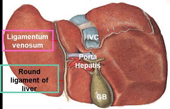 o Its sickle-shaped free margin contains the ligamentum teres (round Ligament) of liver, the remains of the umbilical vein (oblitrated umbilical vein), which carried