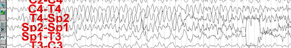EEG: Simple