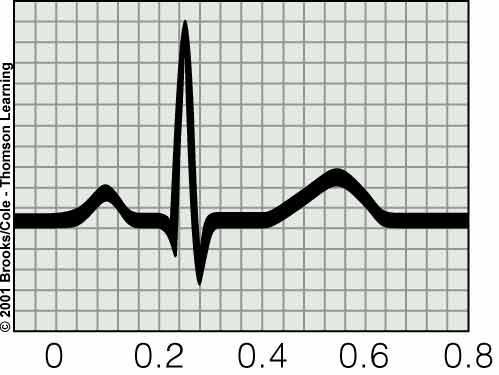 P wave Electrocardiogram (ECG) Atrial contraction (depolarization) QRS wave T