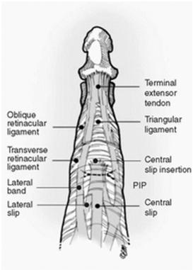 Mechanism Disruption or lengthening of central slip Lateral bands slip volar to PIP axis of motion & act as flexors Central slip inserts into base of the middle