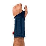 6.1 Korištenje udlaga Imobilizacija ručnog zgloba udlagom također je vrlo česta i korisna terapijska mjera.