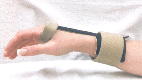 ) koji se koristi su udlage koje ručni Slika 7. Airflex udlaga za ručni zglob zglob imobiliziraju u položaju 15 ekstenzije ili udlage koje ručni zglob drže u neutralnom položaju.
