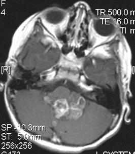 contrast axial MRI
