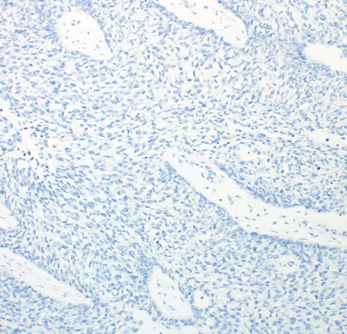 Guidelines for Scoring PD-L1 IHC 28-8 pharmdx Agilent emphasizes that scoring of PD-L1 IHC 28-8 pharmdx must be performed in accordance with the
