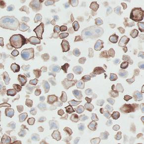 Stained with PD-L1 Primary Antibody Positive Control