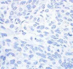 Antibody ACCEPTABLE ACCEPTABLE ACCEPTABLE 4B Negative Control Tissue Stained with