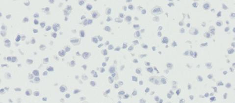 Patient Specimen Stained with Primary Antibody Staining should be assessed within the context of any non-specific background staining of the patient specimen stained with Negative Control Reagent.