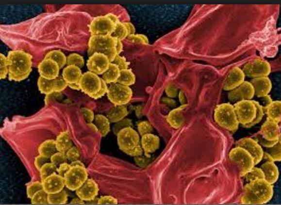 Staphylococcus Aureus Xuất hiện từ