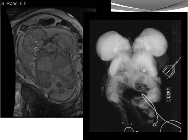 kidneys with renal ultrasound If polycystic?