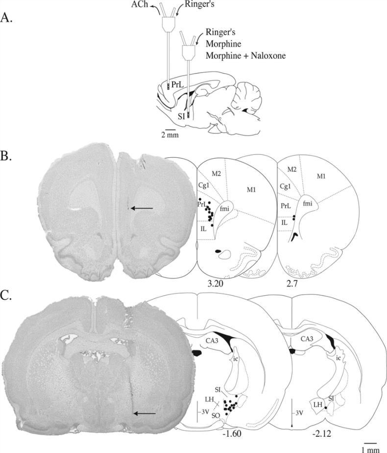 A Mechanism for Opioid Induced Sedation µ receptor activation hyperpolarizes cholinergic neurons