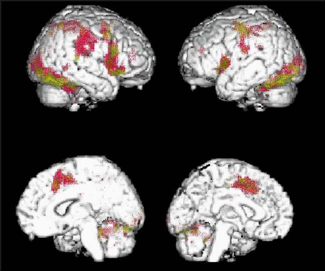 areas (note: not primary visual cortex!).