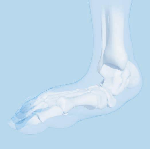 Indications The Depuy Synthes 6.5 mm Midfoot Fusion Bolt is indicated for fracture fixation, osteotomies, nonunions, and fusions of large bones in the foot and ankle.