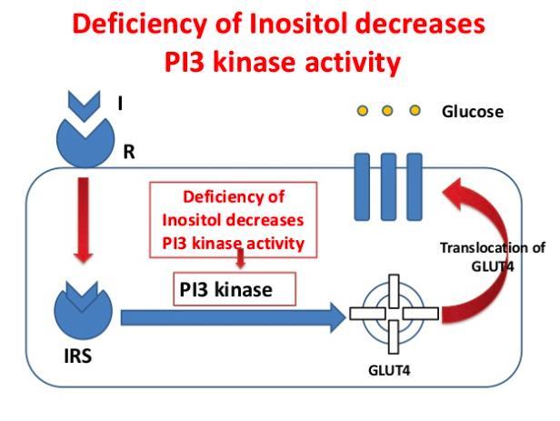 Inositol & PCOS In women with PCOS, a deficiency of IPGs in tissues, or An altered