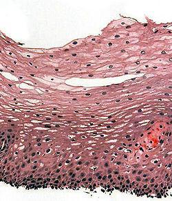 H&E stain of biopsy of normal