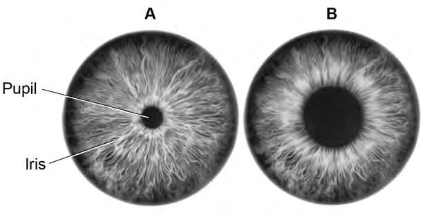 16 0 5 Figure 4 shows a reflex in the iris of the human eye in response to changes in light levels. Figure 4 0 5.