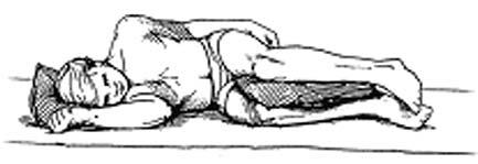 Getting out of bed Obtain assistance as needed. Roll onto your side and bring your knees up towards your abdomen. Place your upper hand on the bed below your elbow.