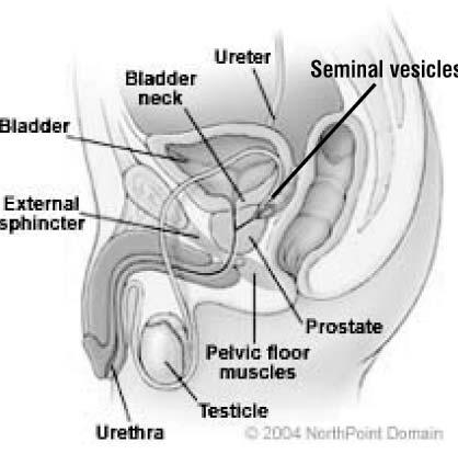 In men, the nearby organs that are removed are the prostate and the seminal vesicles (a pair of pouch-like glands found on each side