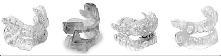 Dental Devices For OSA Most work as mandibular advancing devices by advancing