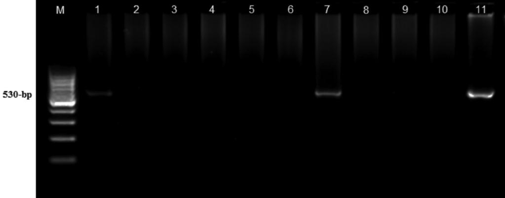 Fig 1 Electrophoretic separation of G. intestinalis tpi nested-pcr amplicons. Experimental protocols are described in Materials and Methods. Lane M, 100-bp DNA size markers; lane 1, G.