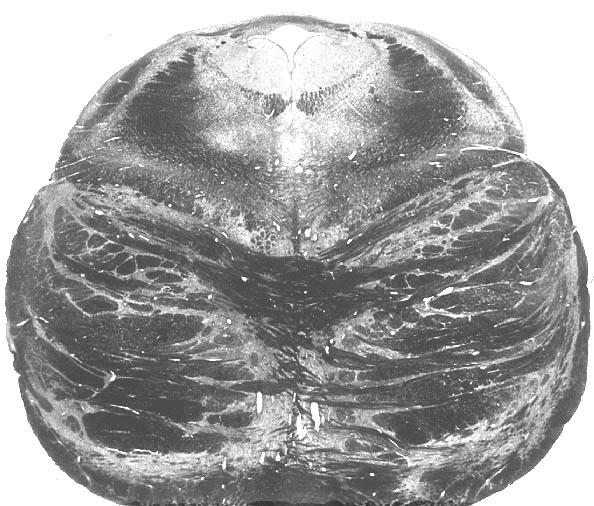 D. Cortical Localization Postcentral gyrus is Somatosensory Cortex Paracentral lobule E.