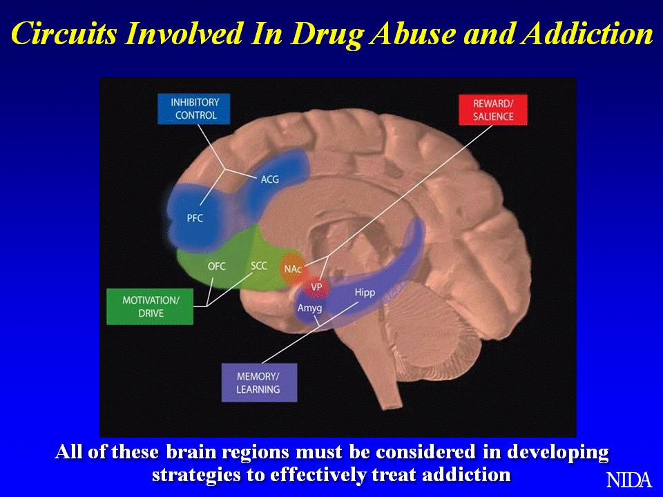Drug use over time affects brain