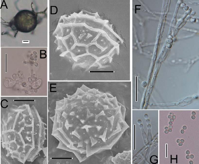 e-issn:2320-3528 Morphological characters of ascospore determined by SEM Material for observation was prepared by cultured at CA media for 4 weeks.