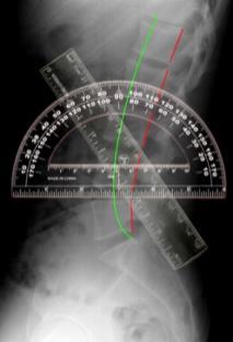Spine Surgeons Lack Reliable Function Tests Critical to Other Surgeons Functional