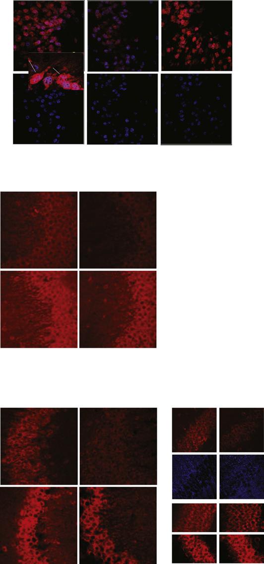 Figure 6. Regulation of Wnt7a/b in Hippocampal CA3 (A) Regulation of Wnt7a/b immunoreactivity by synaptic activity in organotypic slice cultures.