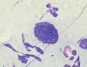 These cells are also phagocytic and are capable of ingesting bacteria and fungi. Finding eosinophils on skin cytology suggests the presence of parasites, fungi, or food allergies.