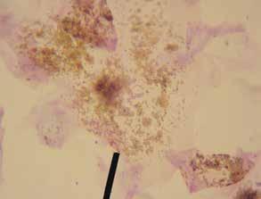 purple; they do not distinguish gram-positive from gram-negative bacteria. Bacterial cultures should be performed any time rods are seen on cytology.