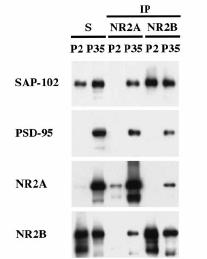 NR2B always immunoprecipitates more SAP-102 than PSD-95.