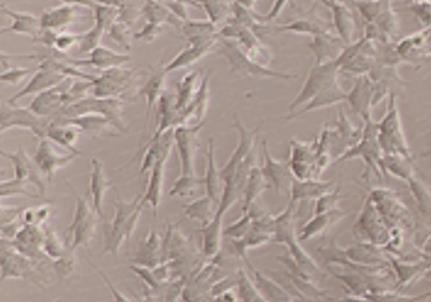 In vitro comparative study SH-SY5Y cells: Species: HUMAN NEUROBLASTOMA (Undifferentiated)