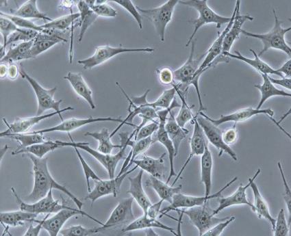Gustincich (SISSA) GI-ME-N cells: Species: HUMAN NEUROBLASTOMA (Differentiated) Derived from a